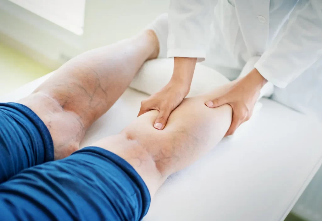 The Significant Role Of Vascular Surgeons In Diabetic Care