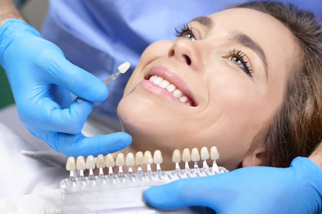 What Are the Benefits of Professional Teeth Whitening?