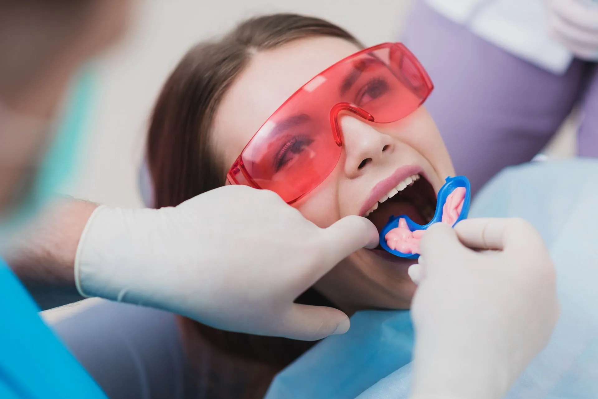 5 Reasons to Consider Getting a Fluoride Treatment in Abilene