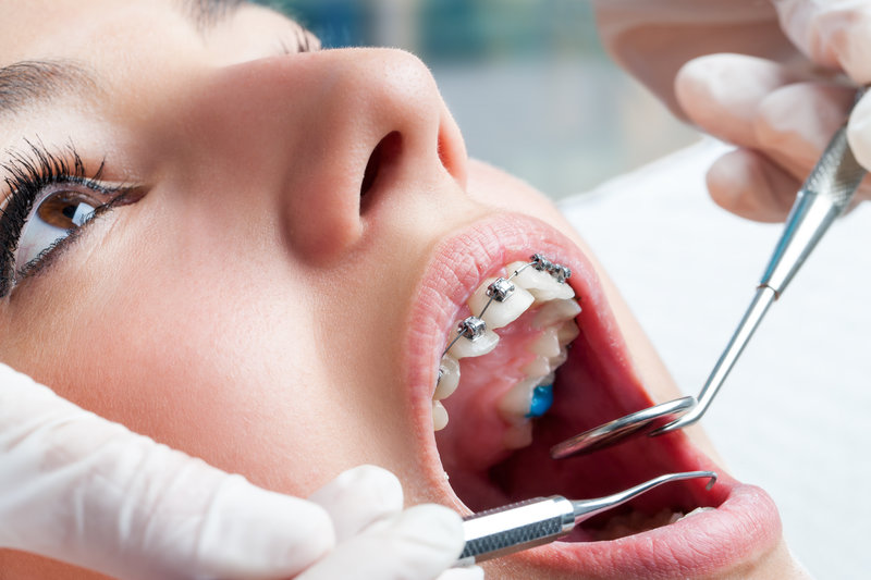 The Importance of Early Dental Care: What Your Child’s Dentist Wants You to Know
