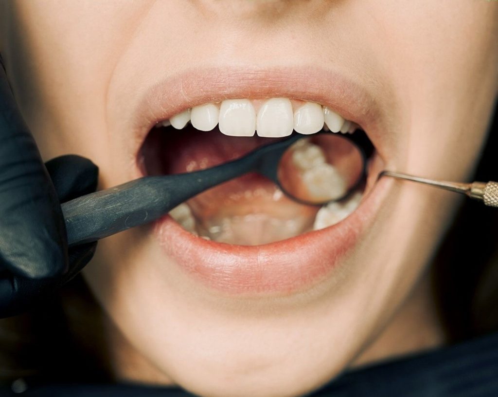 The Essential Link Between Oral Health and Overall Well-Being 