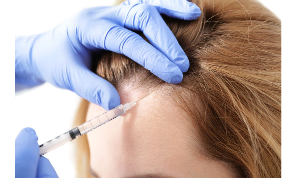 How Stress Affects Hair Loss and What You Can Do