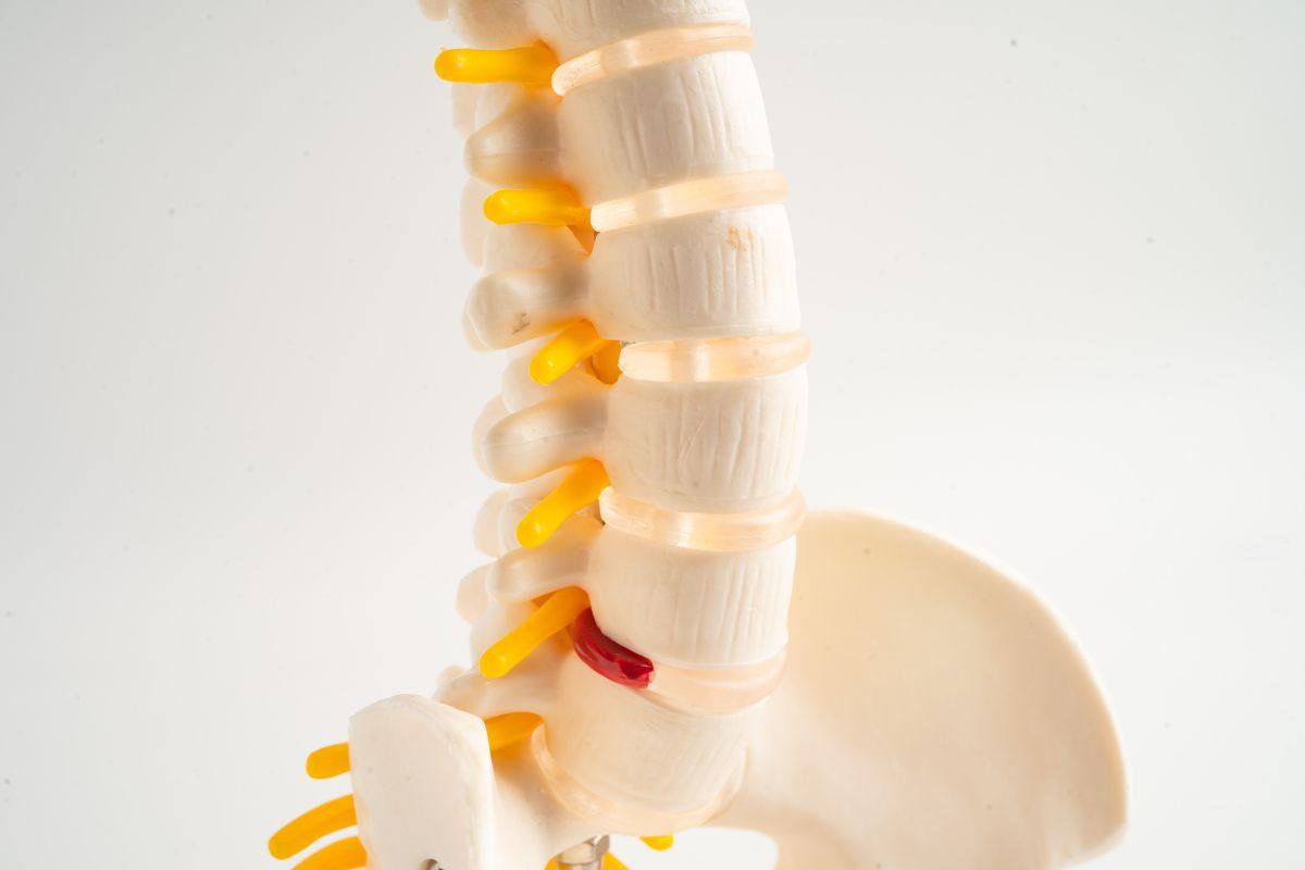 Here’s What to Do Right After a Degenerative Disc Diagnosis