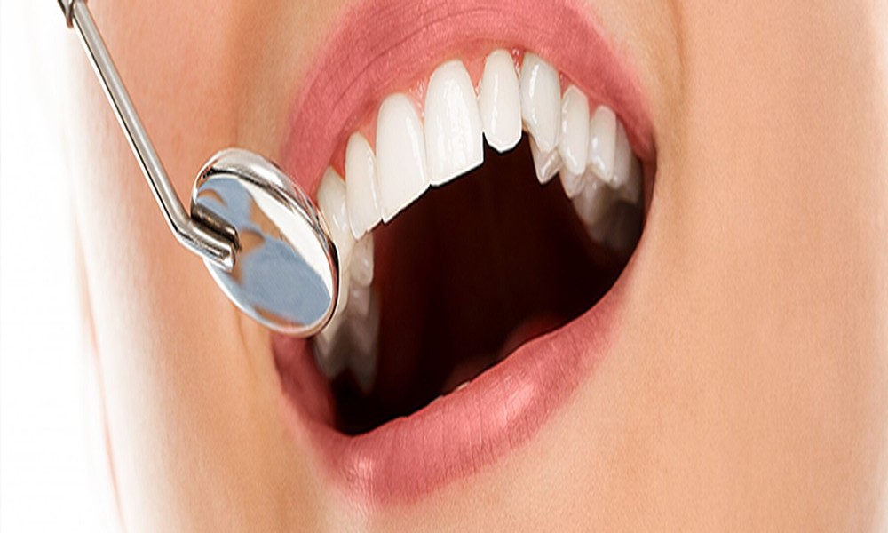 Cosmetic Dentistry Explained: Improving Smile Confidence